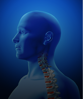 spinal cord tumors