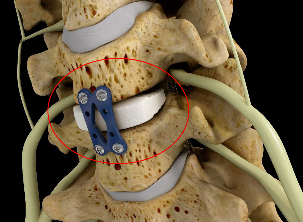 Pituitary