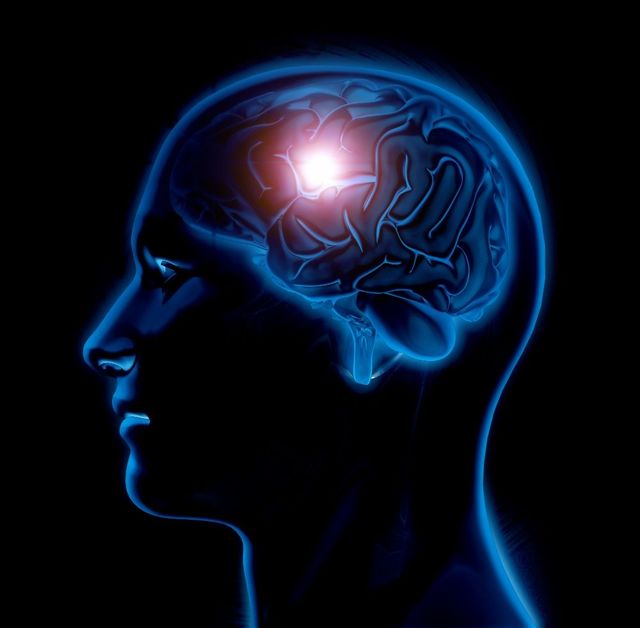 cranial nerve