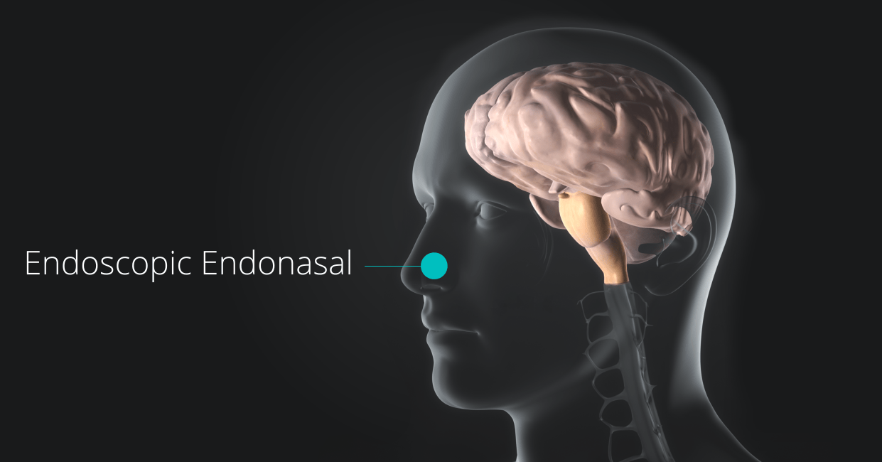 Pituitary