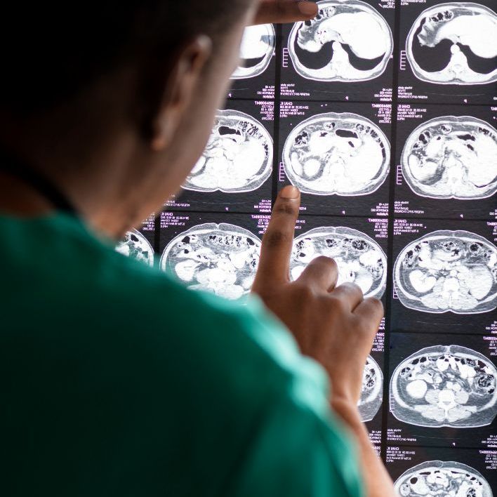 Neurosurgery