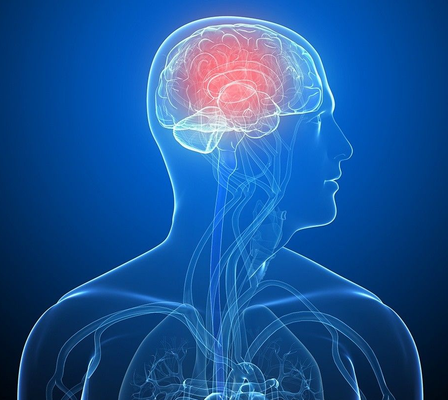 Schwannoma