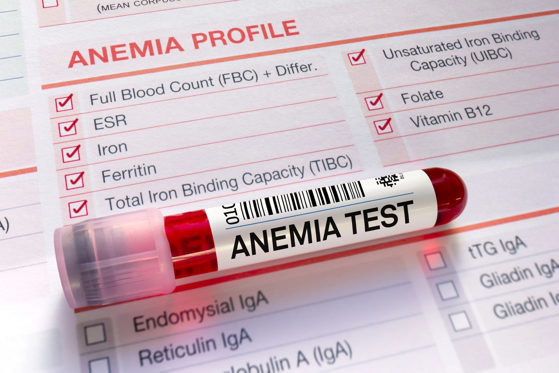 Provetta per analisi del sangue etichettata