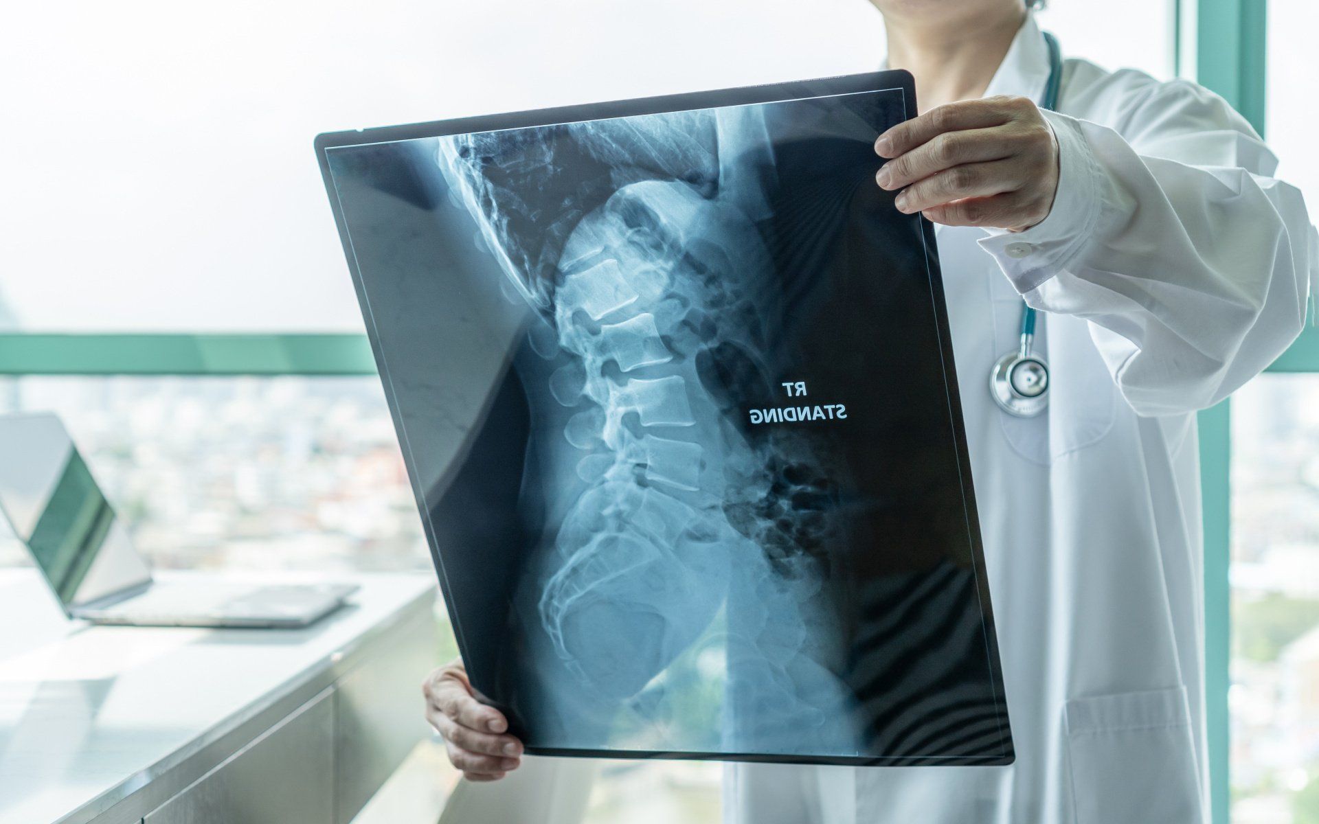 doctor-holds-xray