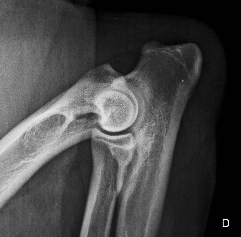 Radiografia