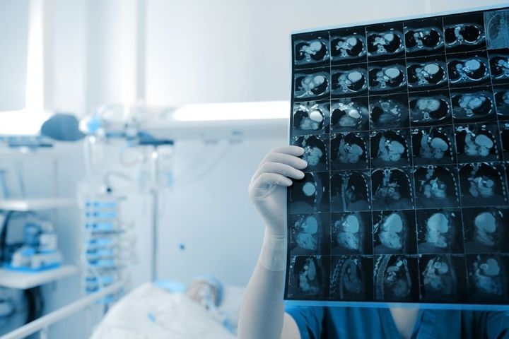 Diagnosi tumorali