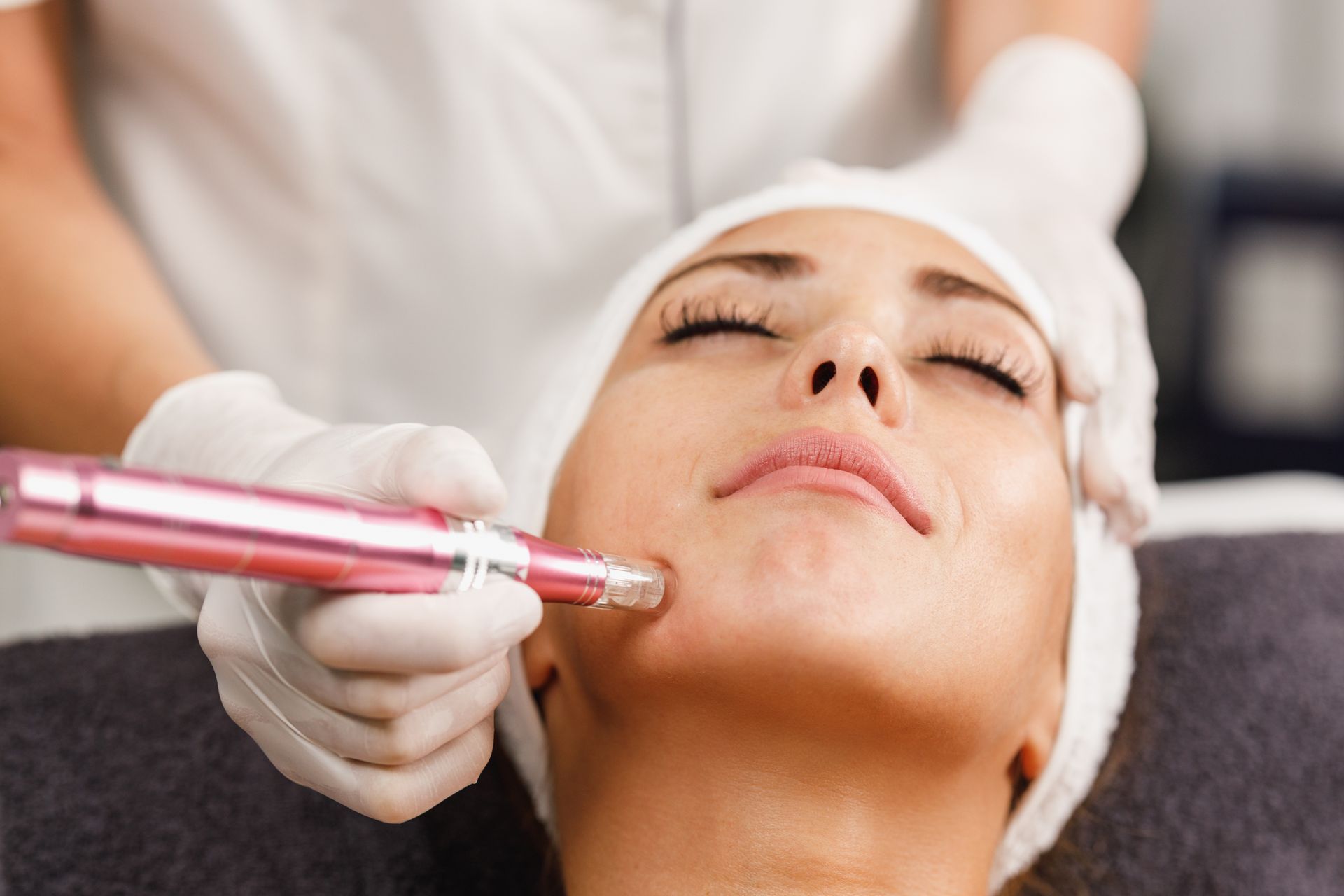 Gloved practitioner using a pink microneedling pen on a client’s chin in a spa treatment room