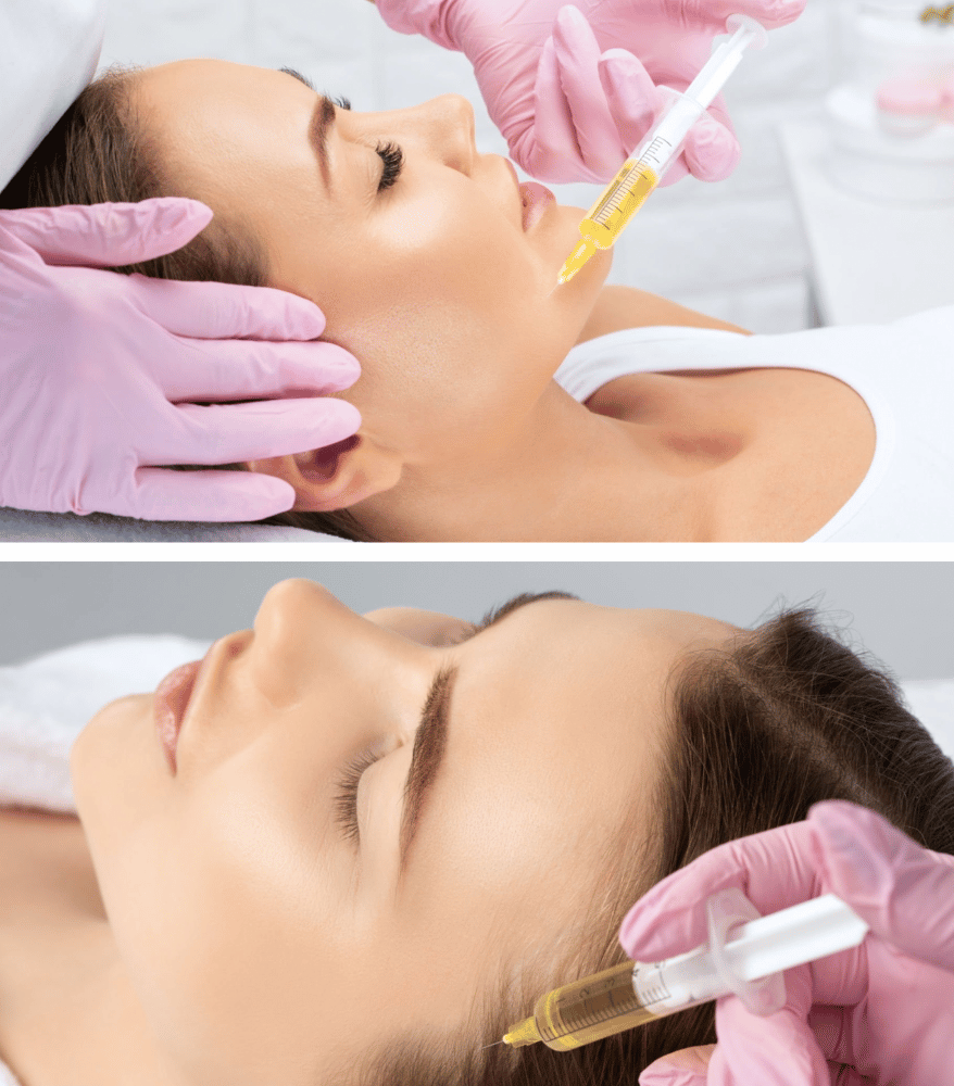 PRP by dr ghizlaine hayou
