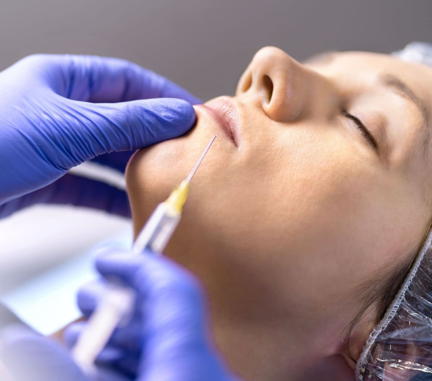 Filler Dr Ghizlaine HAYOU: Médecin Esthétique