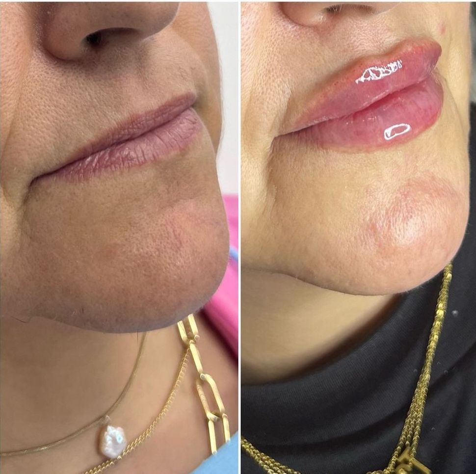 filler Aesthetic Clinic by Dr Ghizlaine Hayou