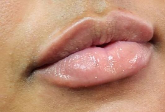 Close-up of a person's lips. The lips are full and shiny, with a pale pink hue.