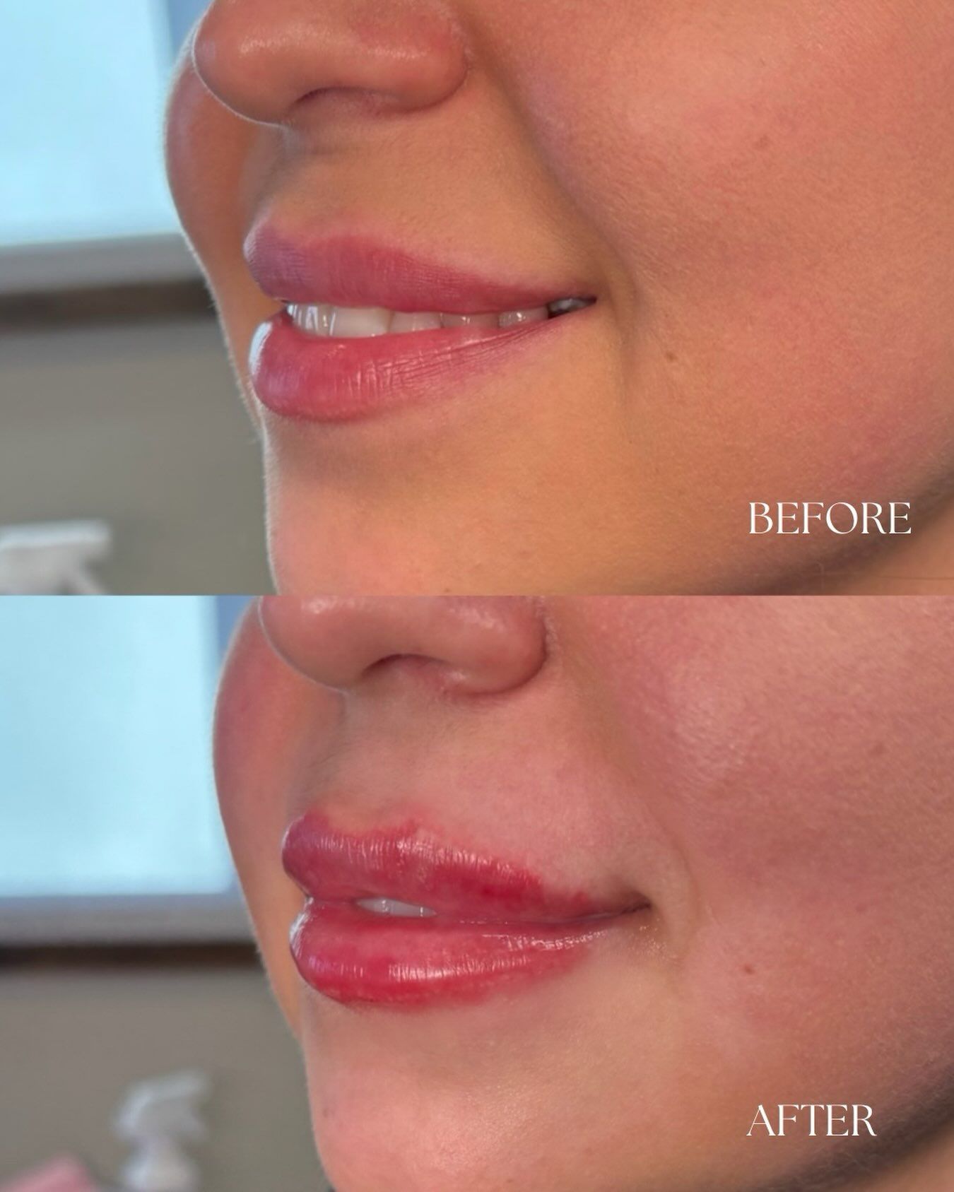 Before-and-after close-up of lips: natural pink top, glossy red bottom, side profile.