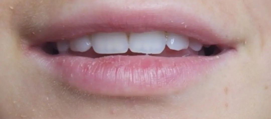 Close-up of a person's slightly parted lips and white teeth. The lips are pink, and the teeth are visible.