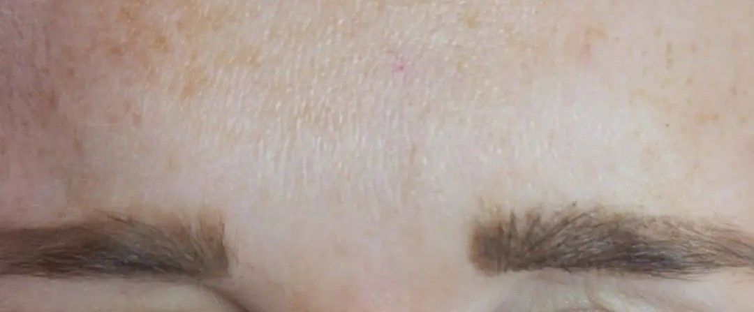 Close-up of a person's forehead, featuring the eyebrows and skin texture with light freckles.