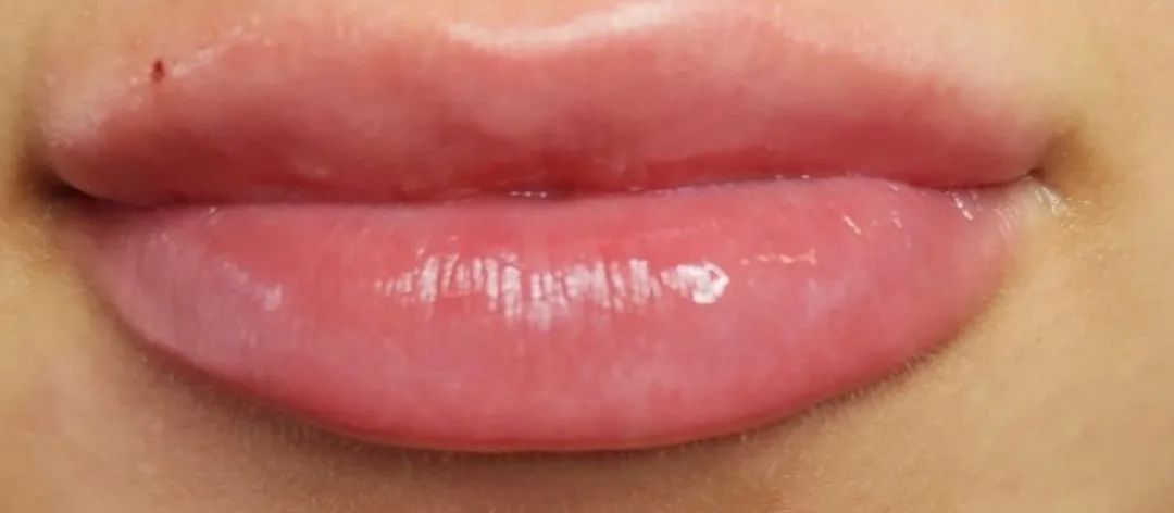 Close-up of full, pink, glossy lips; a small mole is visible above the upper lip.