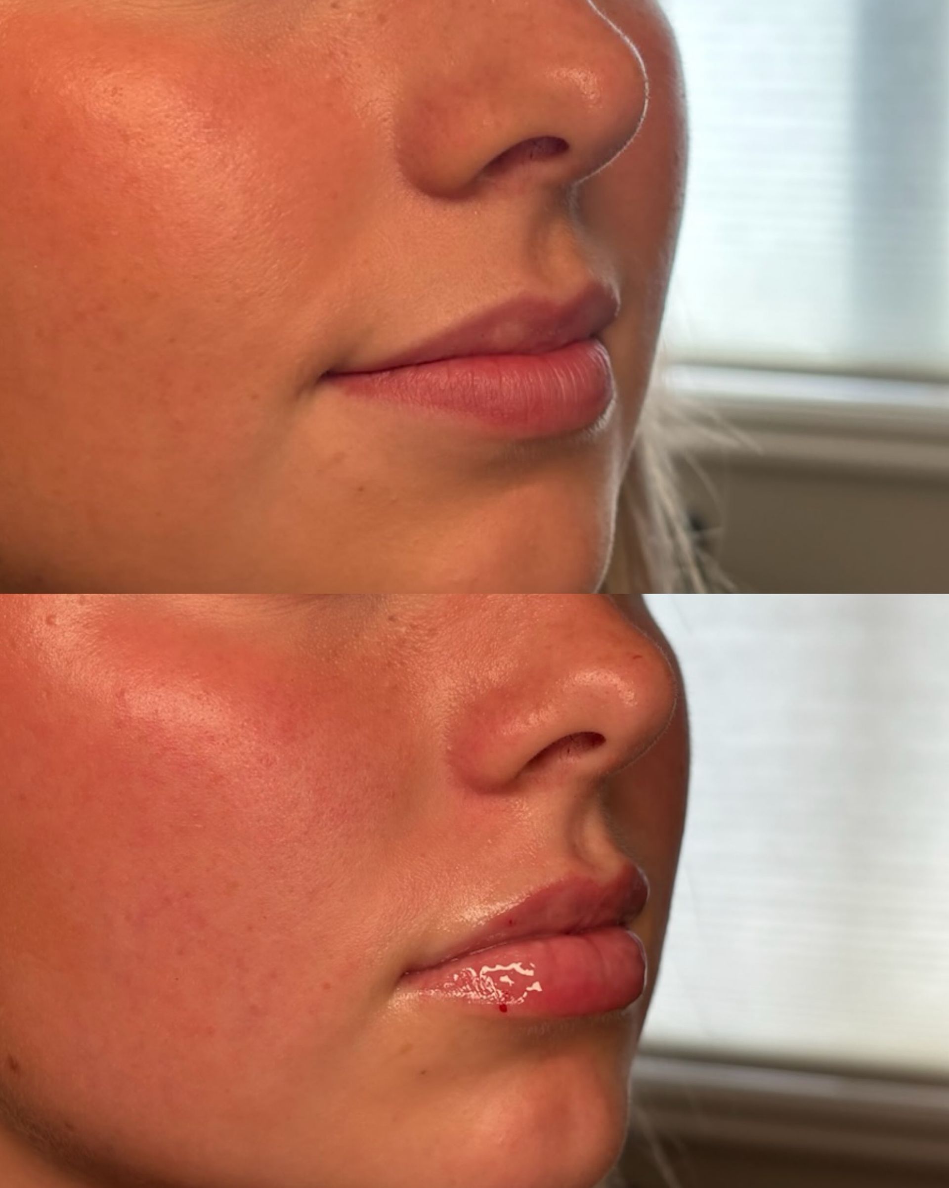 Side-by-side close-up of a face before and after makeup, showing glossier lips and flushed cheeks