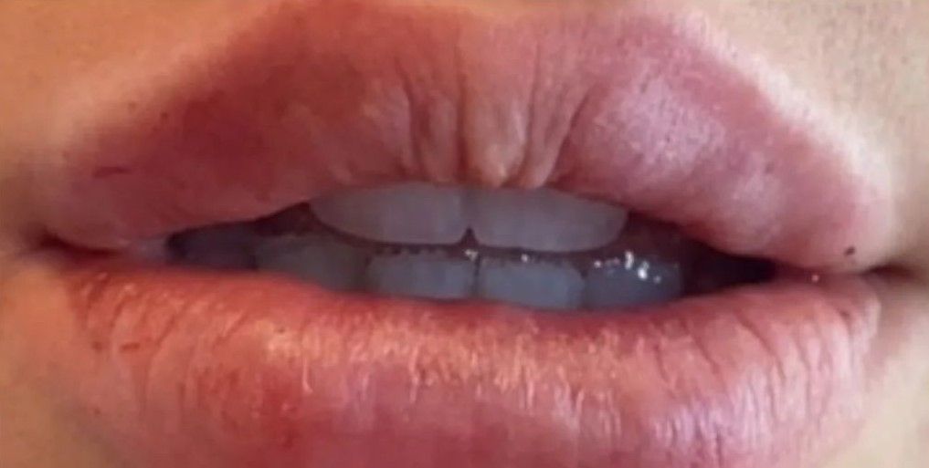 Close-up of human lips, showing pink skin with wrinkles and visible teeth.
