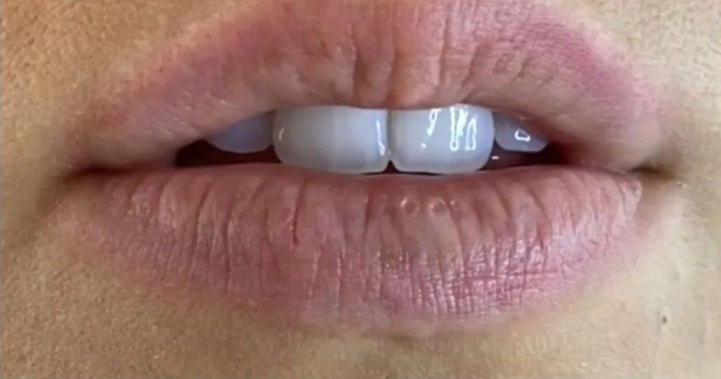 Close-up of a person's slightly open lips with white teeth visible.