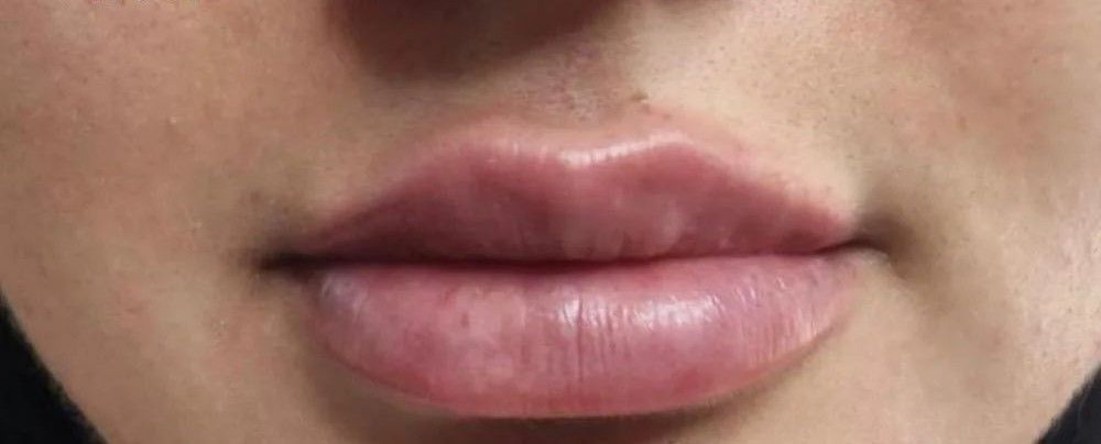Close-up of a person's lips. The lips are full and appear pink. The skin around the mouth is light-toned.