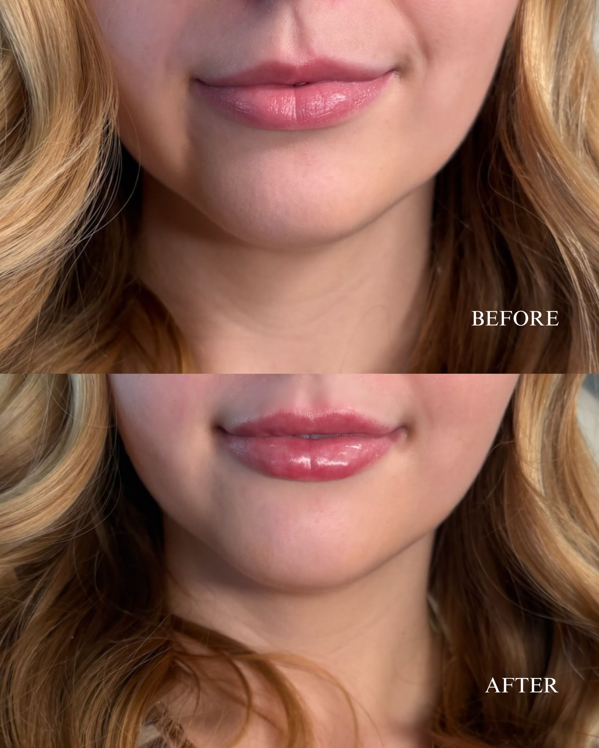 Before-and-after close-up of lips with more defined, fuller appearance in the lower image.