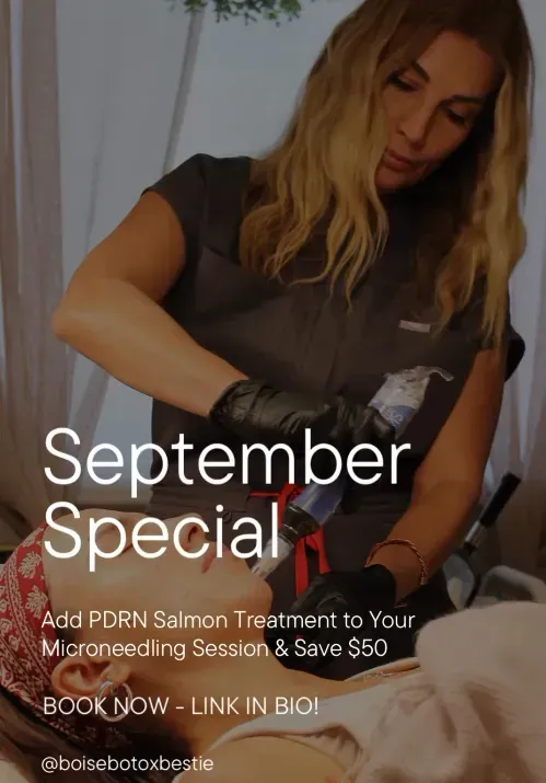 September Special salon ad with woman applying PDRN salmon treatment for microneedling session and save $50