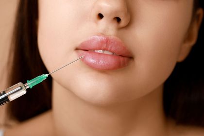 Cosmetic syringe injecting filler into lips in a close-up treatment scene
