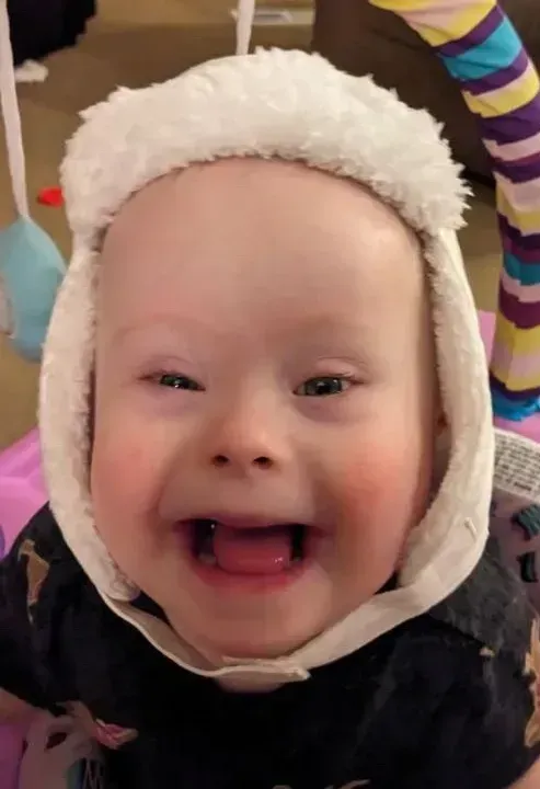 Smiling baby with Down syndrome wearing a white fur hat, pink cheeks, tongue out.