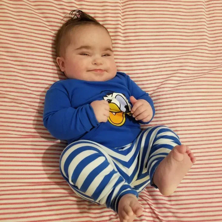 Baby with Down syndrome in blue Donald Duck shirt and striped pants smiles, lying on a striped blanket.