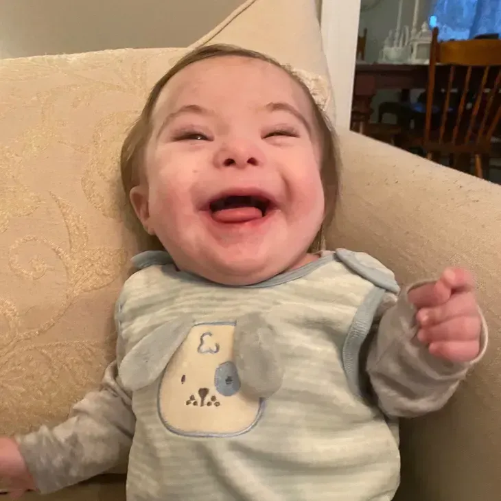 Baby with Down syndrome in striped onesie smiles widely, sticking out tongue. Seated in a chair.