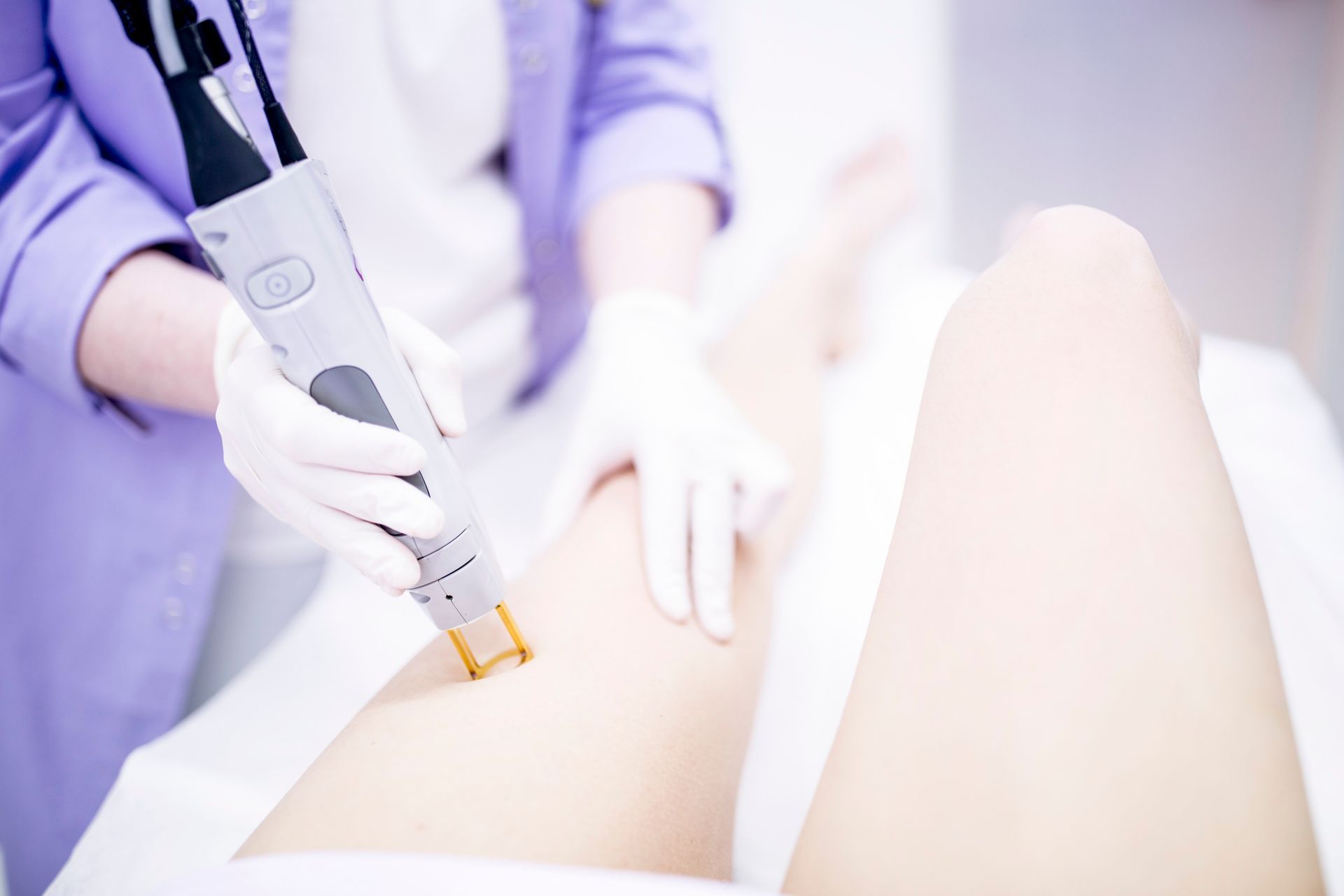 Epilazione laser sulla gamba di una persona, eseguita da un operatore che indossa guanti in un ambiente clinico.