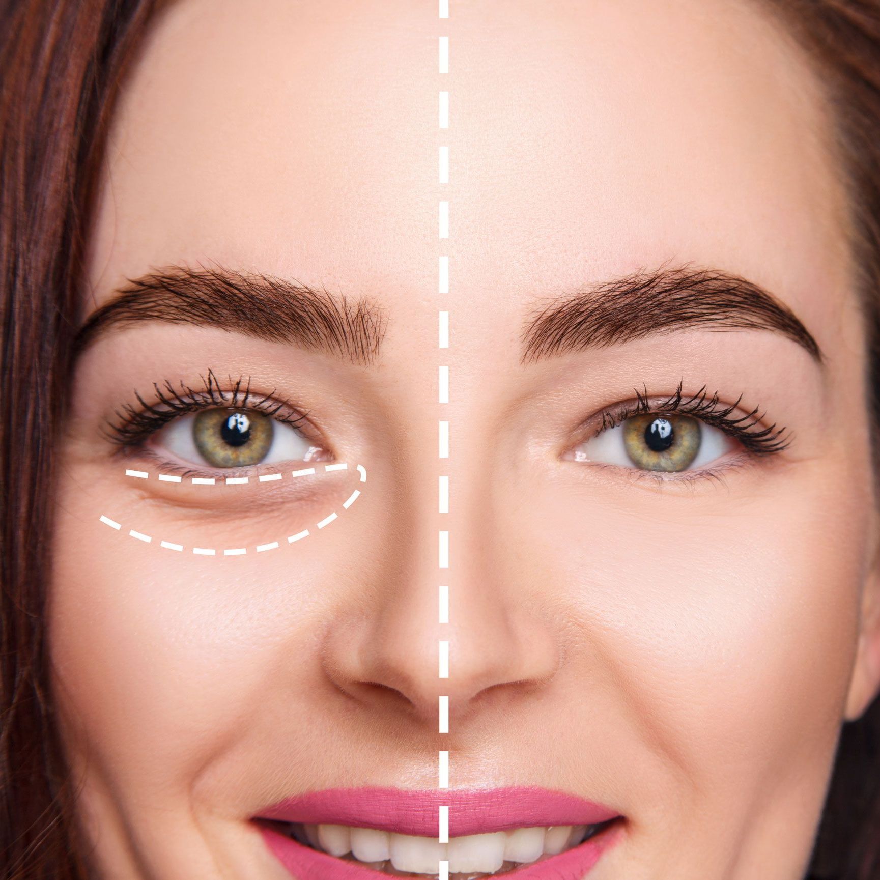 Girl With Smooth Skin
