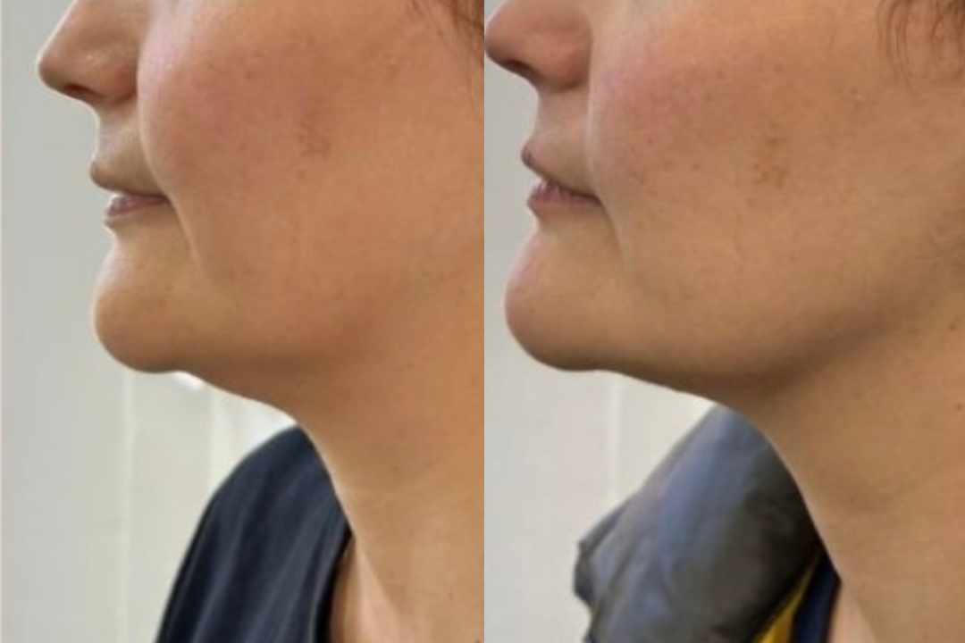 Coastal Cosmetic Injectables