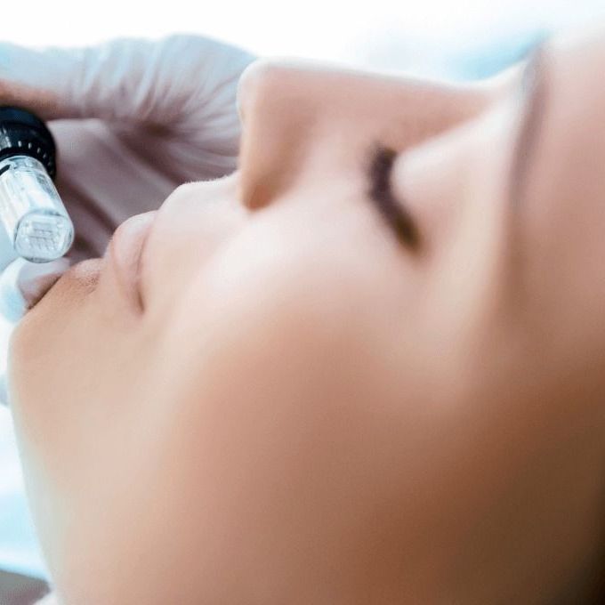 Skin Needling