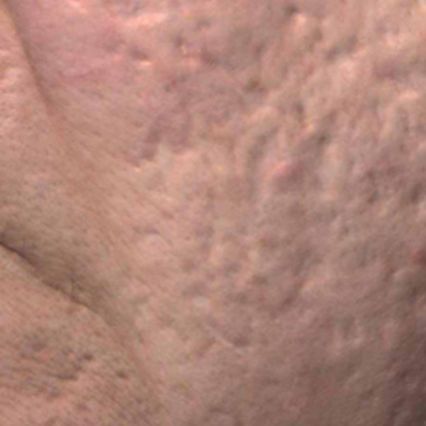 A close up of a person 's skin with a lot of spots on it.