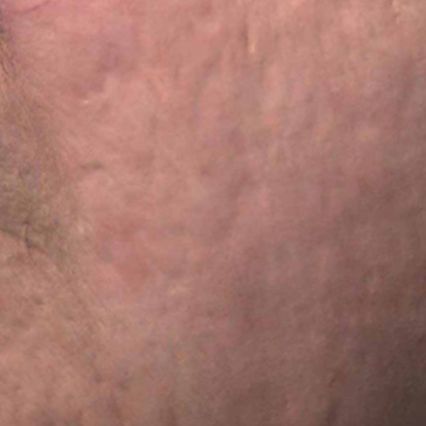 A close up of a person 's face with a red spot on it.