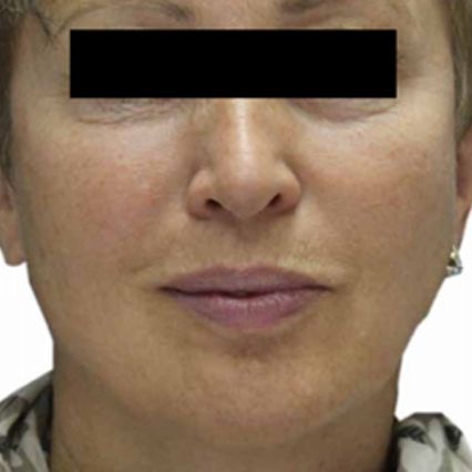 A close up of a woman 's face with a black block on her eyes
