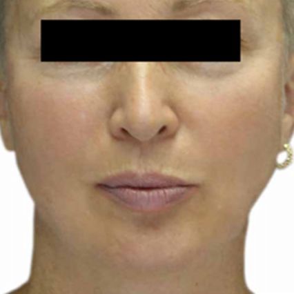 A close up of a woman 's face with a black block on her eyes