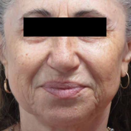 A close up of a woman 's face with a black block on her eyes