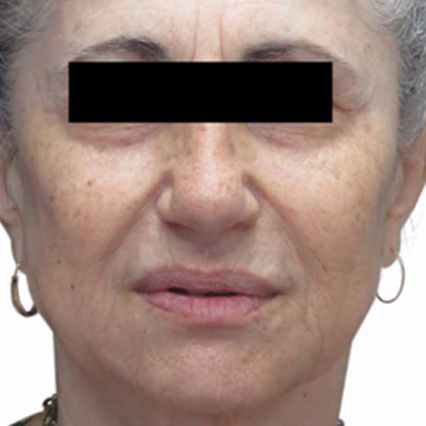 A close up of a woman 's face with a black block on her eyes