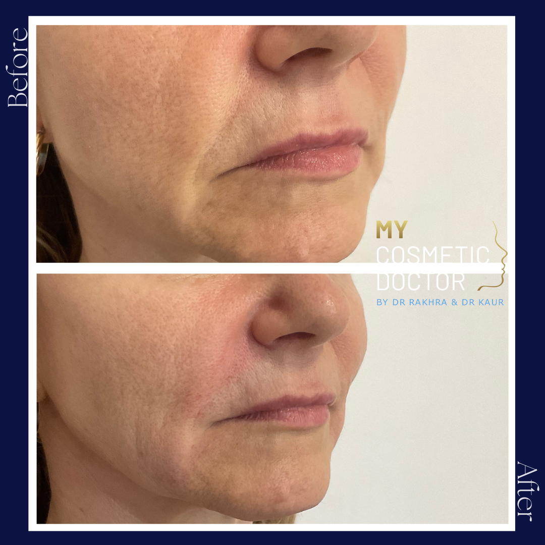 A before and after photo of a woman 's face