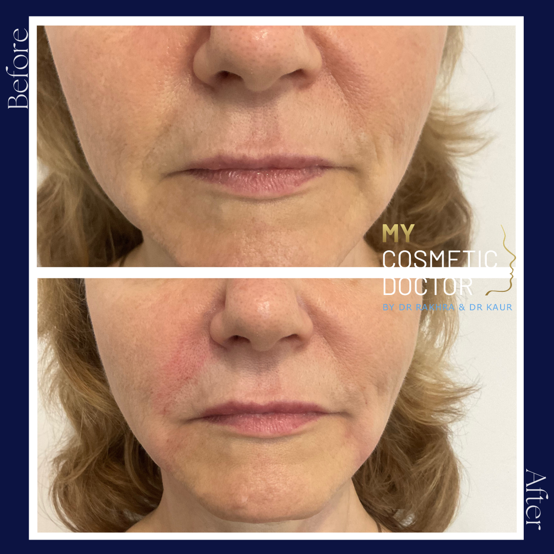 A before and after photo of a woman 's face