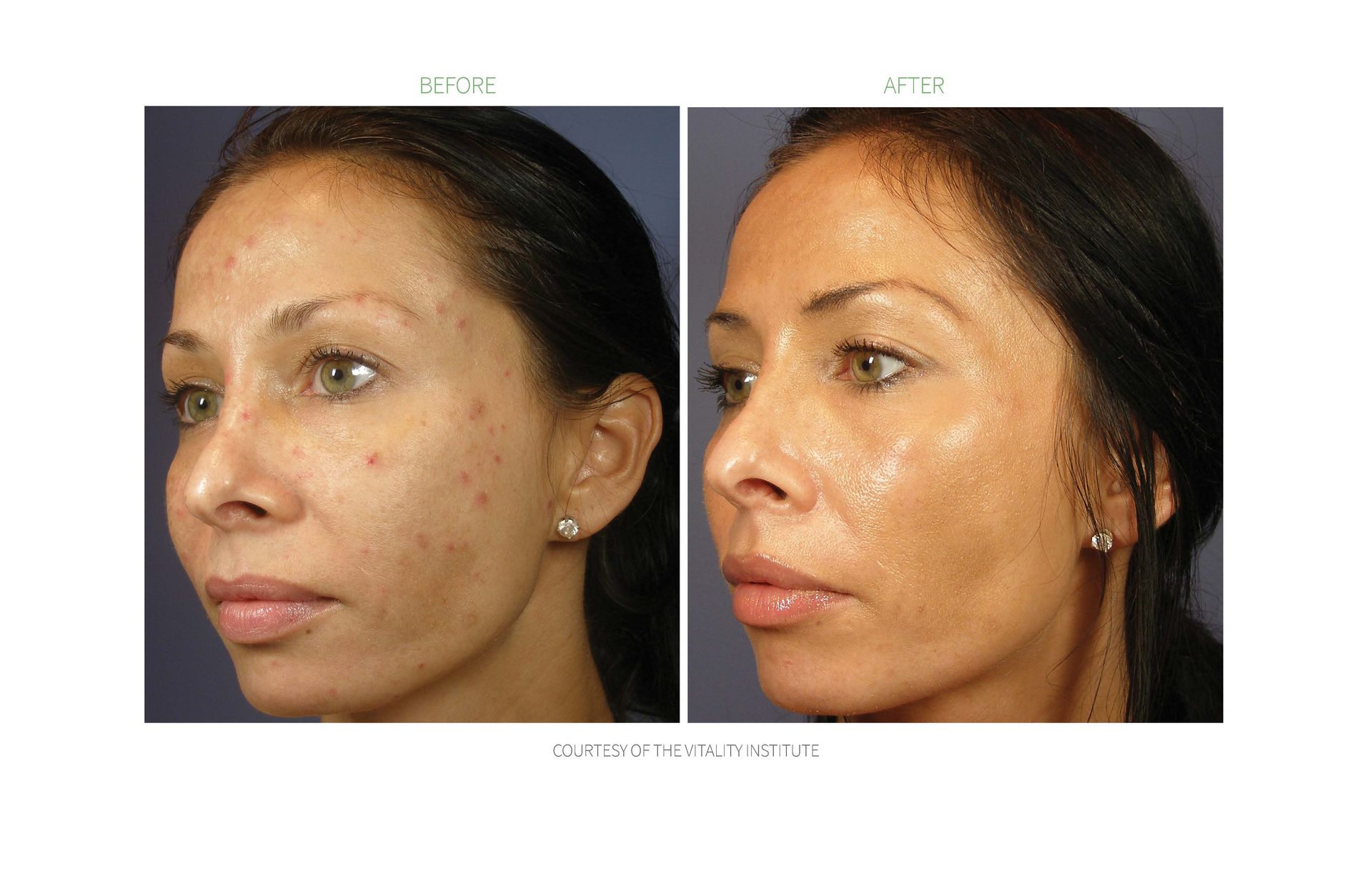 A before and after photo of a woman 's face