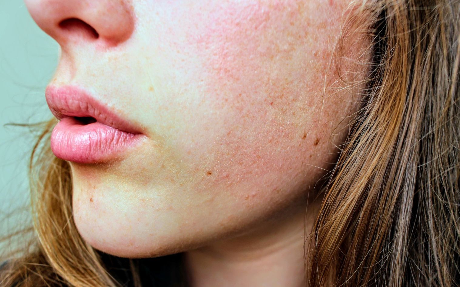 Side Face of A Woman — Allergy Services in Mackay, QLD