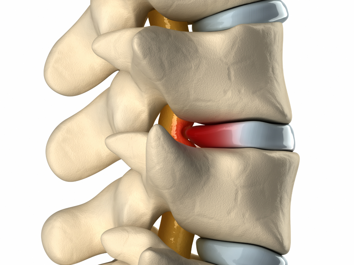 Symptoms of Lower Back Pain