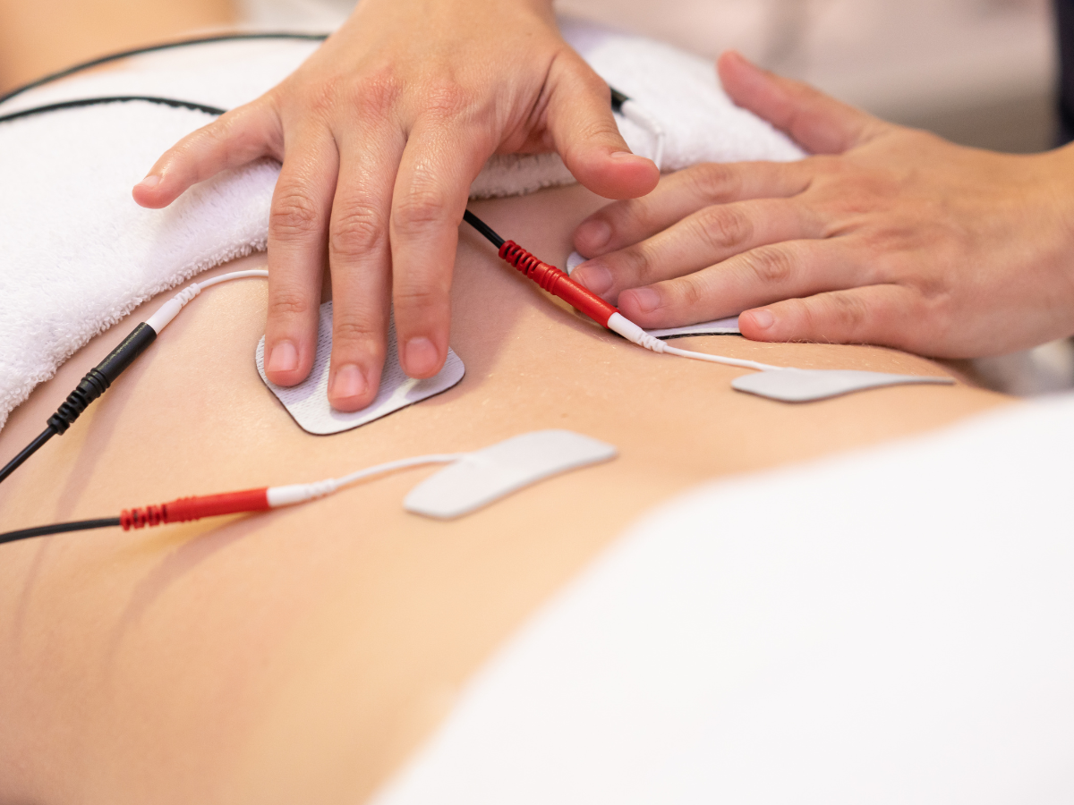 Electrical Stimulation