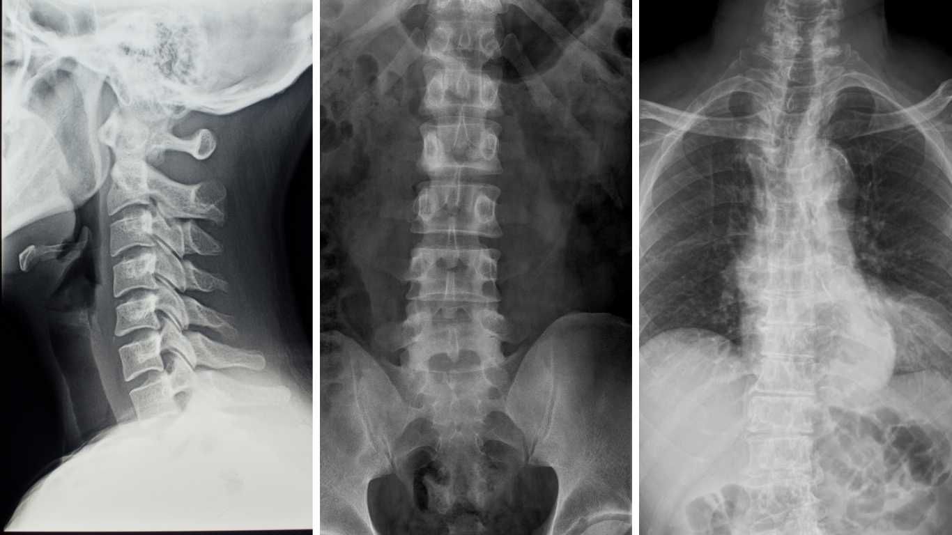 Report of Findings & X-ray