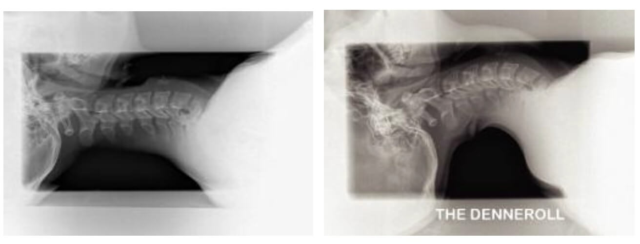 chiropractor for neck pain singapore 2