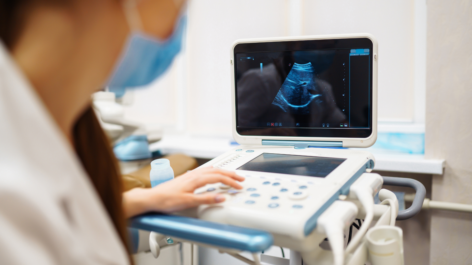 Sonographer using an ultrasound machine beside a monitor displaying a fetus scan