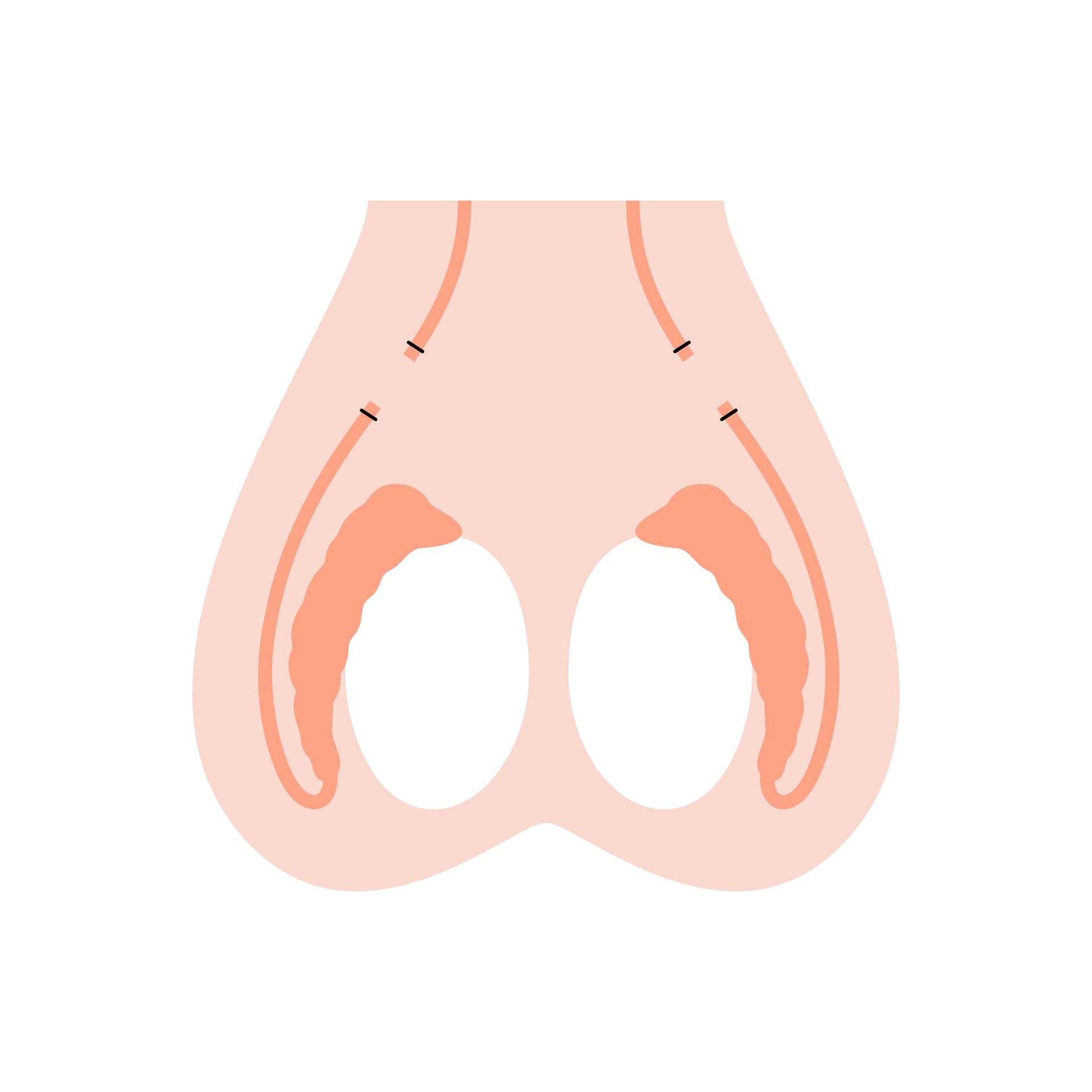 VASECTOMIA