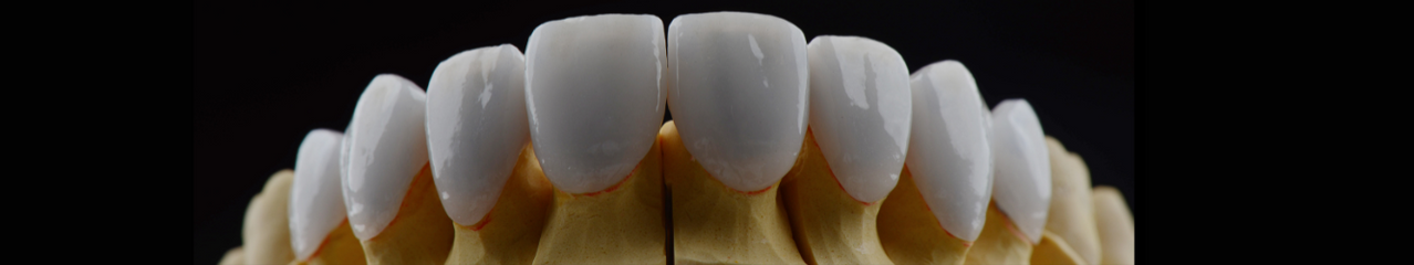 CROWNS AND FILLINGS - TLC Dental Wellness